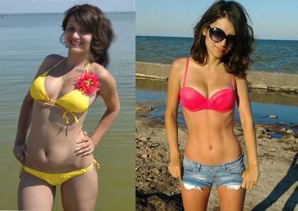 Anna 10 kg-ot fogyott a NexaSlim segítségével